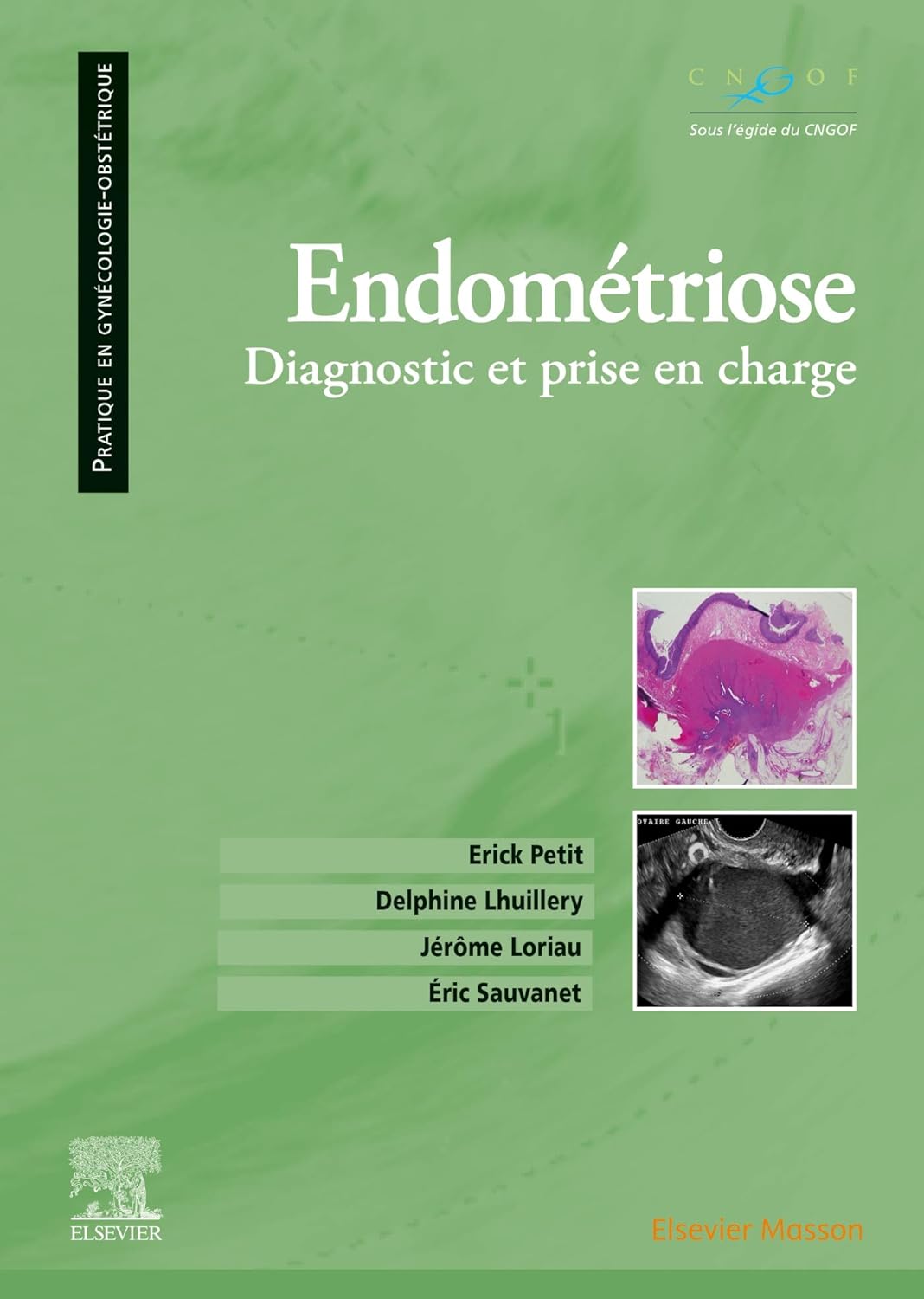 LIVRE - "Endométriose: Diagnostic et prise en charge"